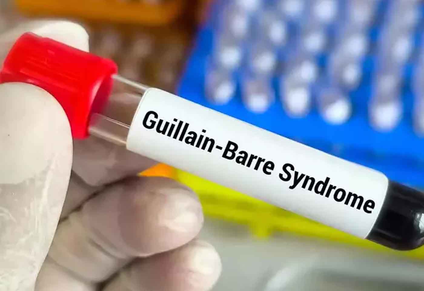 GBS